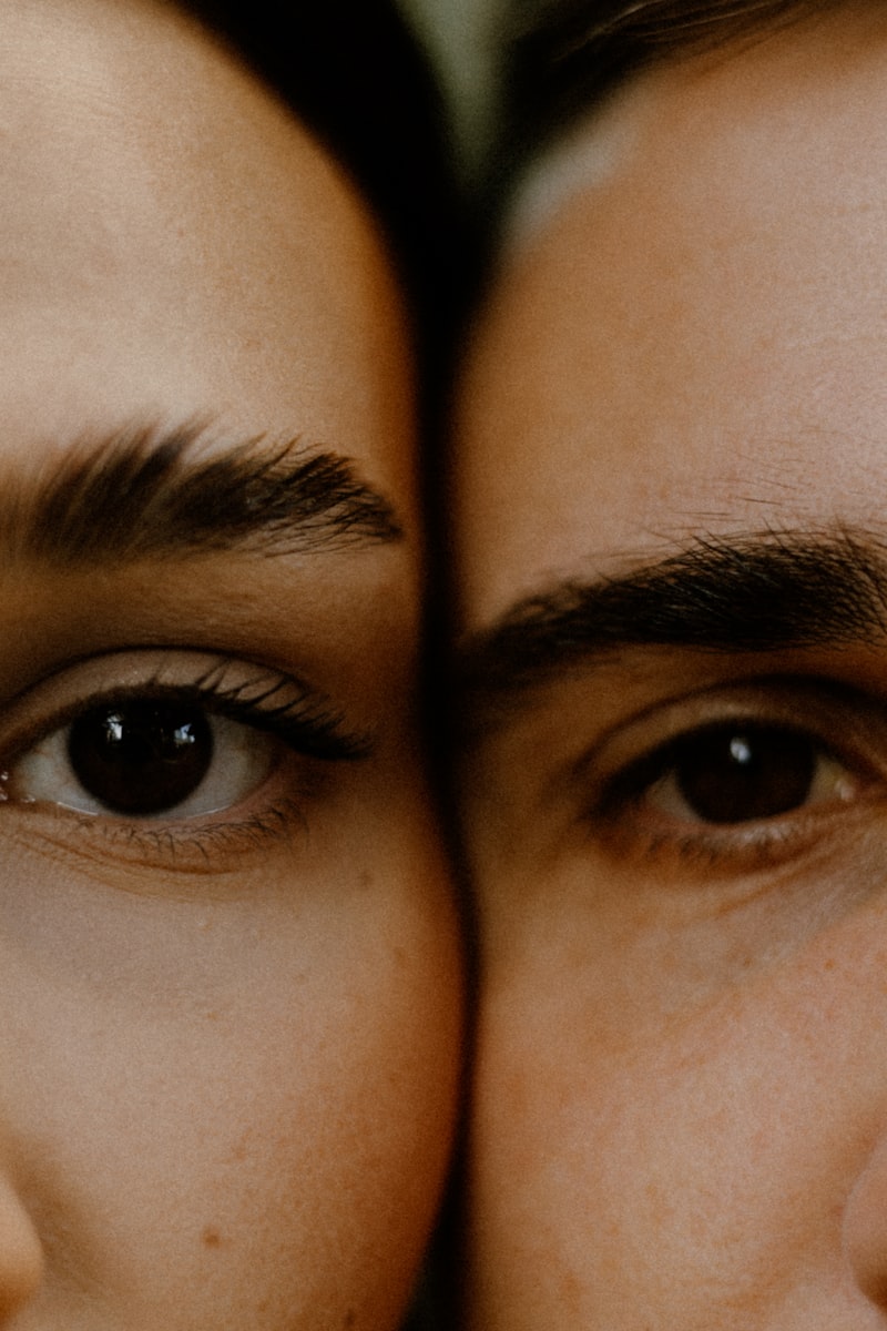 Under-eye filler tear trough